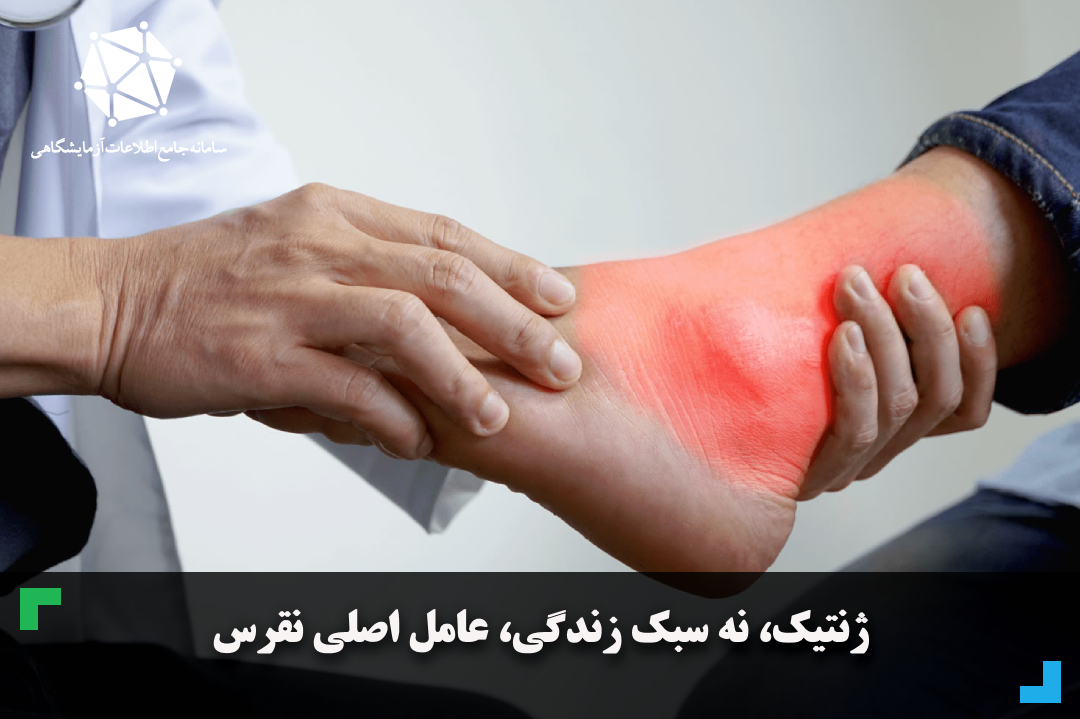 ژنتیک، نه سبک زندگی، عامل اصلی نقرس