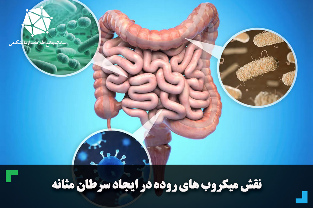 نقش میکروب های روده در ایجاد سرطان مثانه