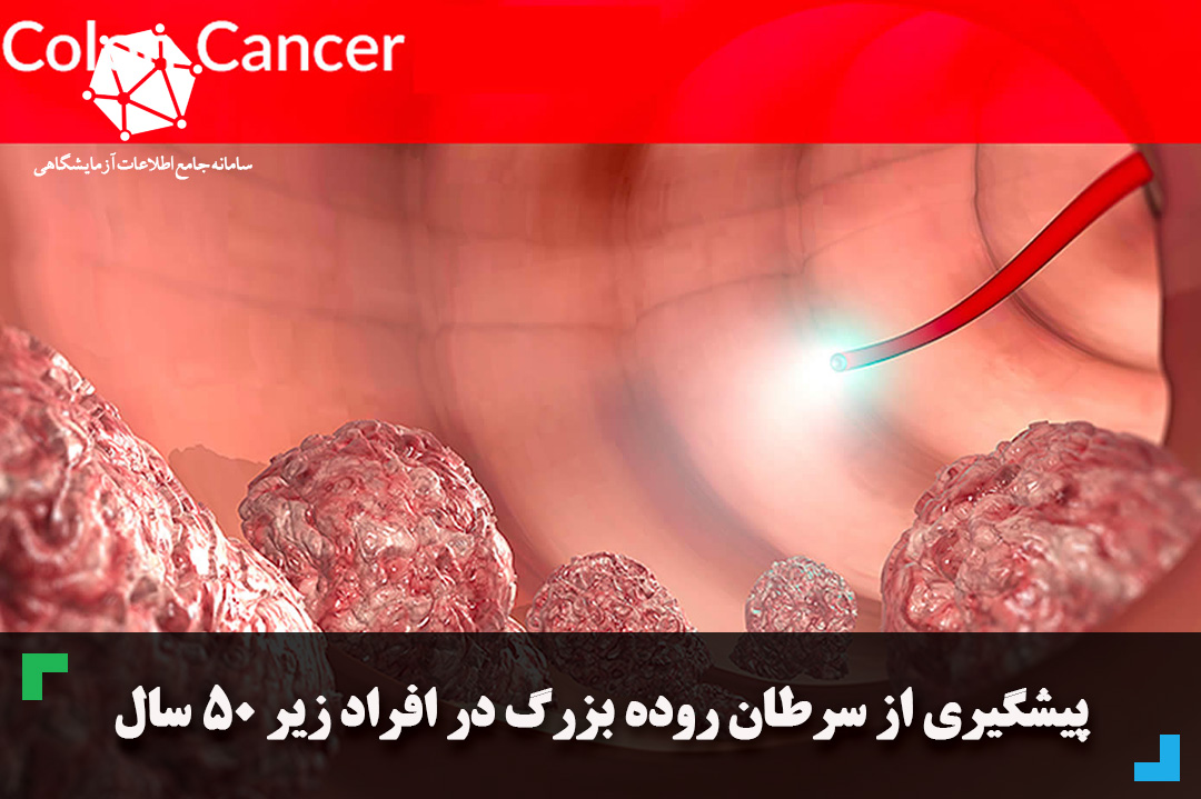 پیشگیری از سرطان روده بزرگ در افراد زیر 50 سال