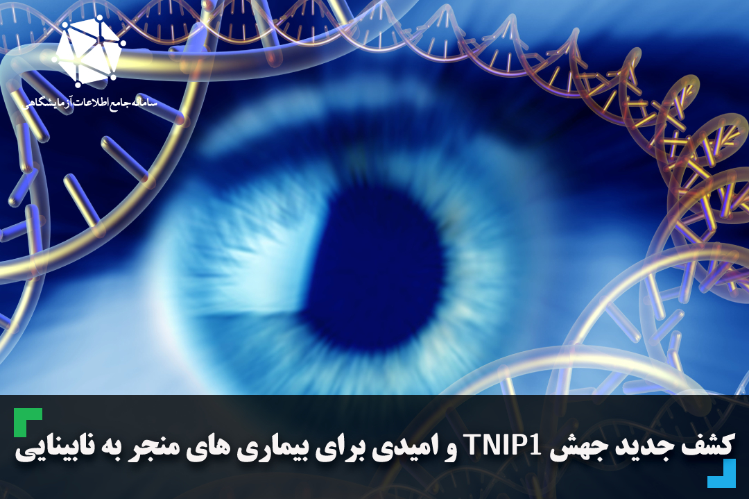 کشف جدید جهش TNIP1 و امیدی برای بیماری های منجر به نابینایی